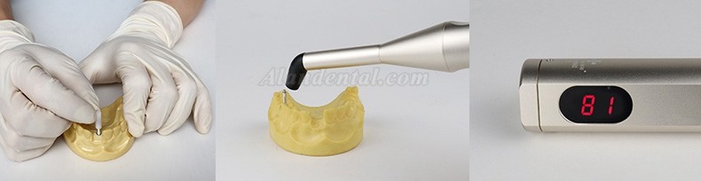 WJ Implant Stability Tester Implant stability Meter (Upgraded)